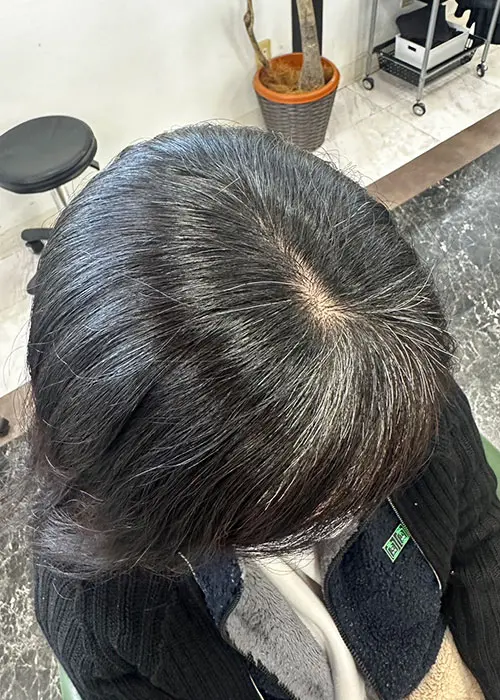 施術イメージ