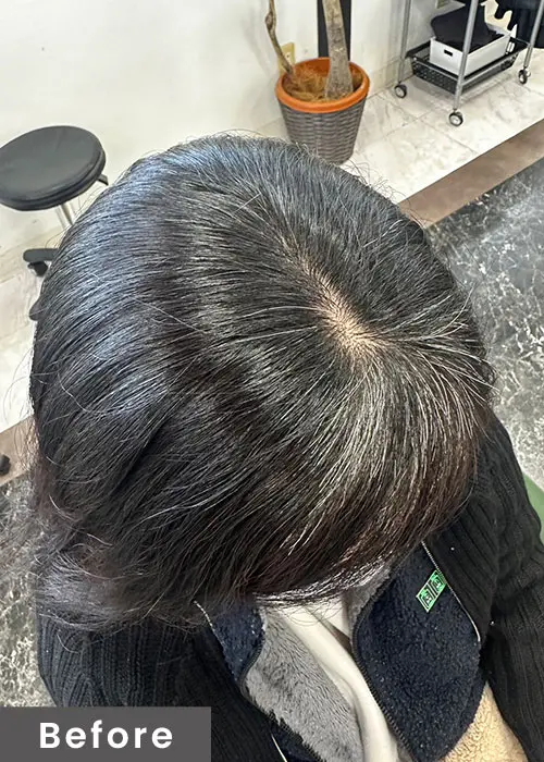 施術イメージ