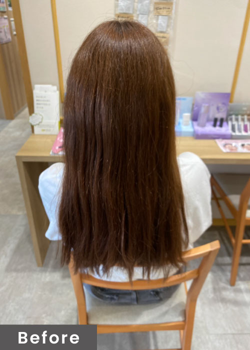 施術イメージ
